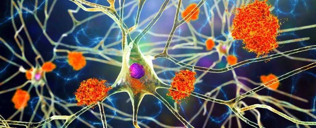 Bilim İnsanları Uyardı: Yaygın Uçuk Virüsü Alzheimer Riskini Artırıyor Olabilir