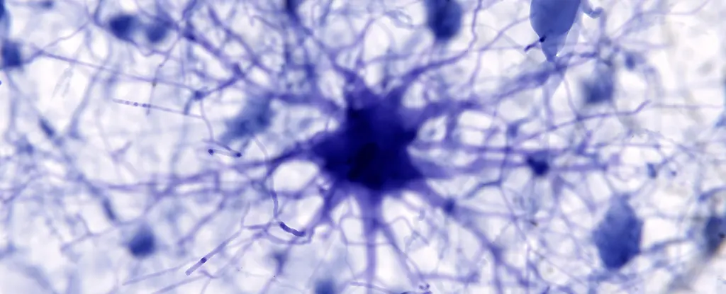 Yapay Zeka, Alzheimer'ın Gizemli Tetikleyicisini ve Potansiyel Tedavisini Ortaya Çıkardı