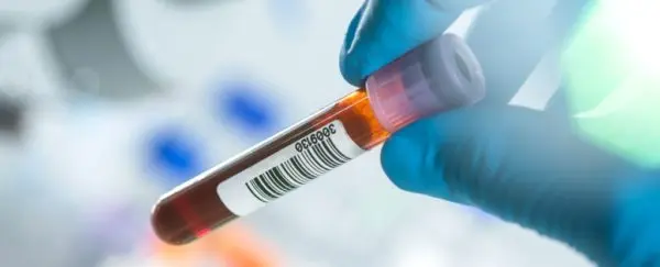 Kandan Alzheimer Teşhisi Artık Mümkün: ABD Onayladı