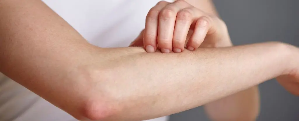 Süper Bakterilere Karşı Cildimizdeki Mantardan Doğal Antibiyotik Keşfi