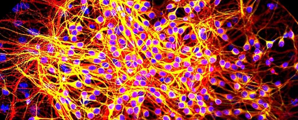 Uyku İlacı Alzheimer'a Karşı Umut Mu Oluyor? Fare Deneylerinde Çarpıcı Sonuçlar