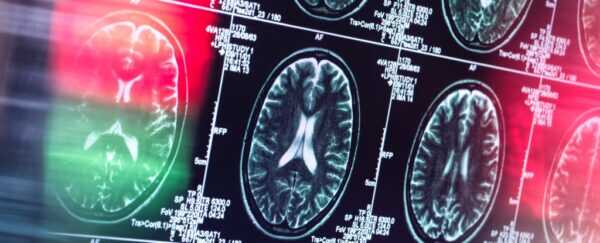 Alzheimer Hastalığı Beynin Bir Hastalığı Olmayabilir mi? Yeni Teori Her Şeyi Değiştiriyor!