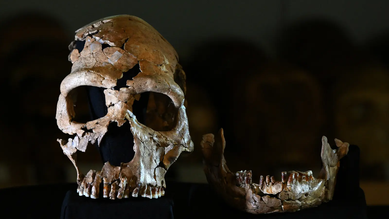 Neandertal Mirası: Kafatasından Beyin Fıtığına Yol Açan Genetik Bağlantı mı?