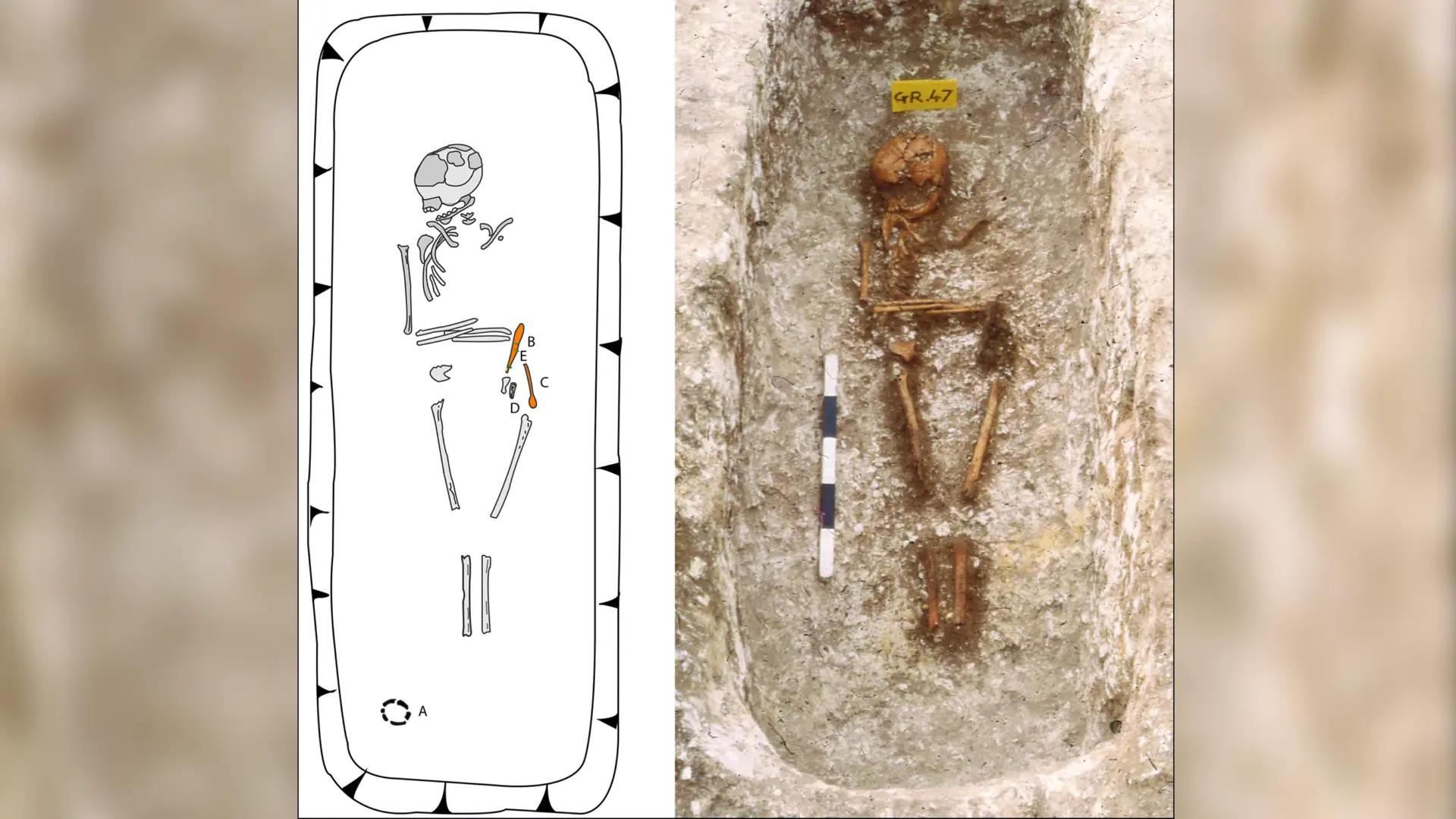 İngiltere'de Bulunan 1300 Yıllık İskeletlerin Ataları Sahra Altı Afrika'dan Çıkıyor: DNA Çalışmaları Ortaya Koydu!