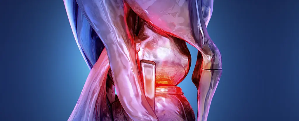 Romatoid Artrit, Belirtiler Ortaya Çıkmadan Yıllar Önce Gizli Bir Evrede Tespit Edilebilir