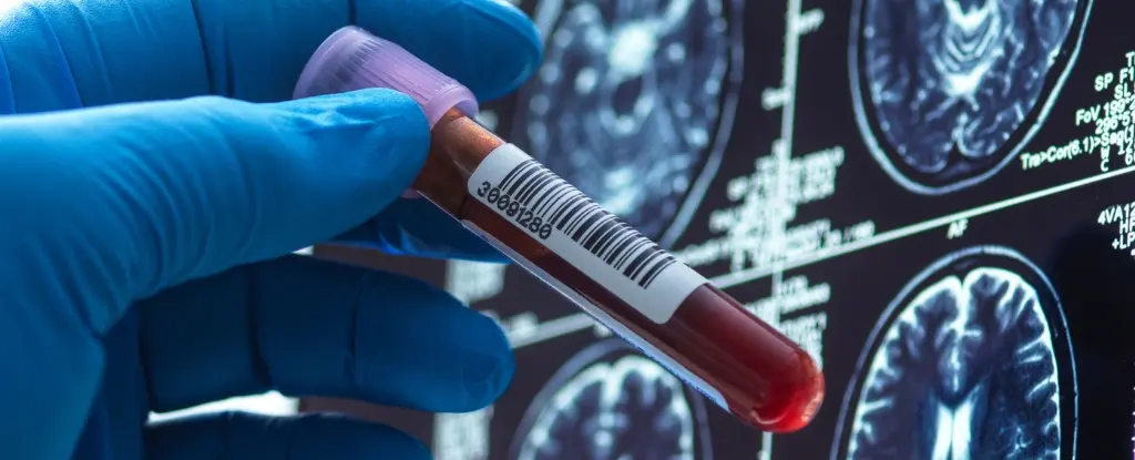 Alzheimer Tedavisinde Umut Işıkları: Yeni İlaçlar ve Tanı Yöntemleri