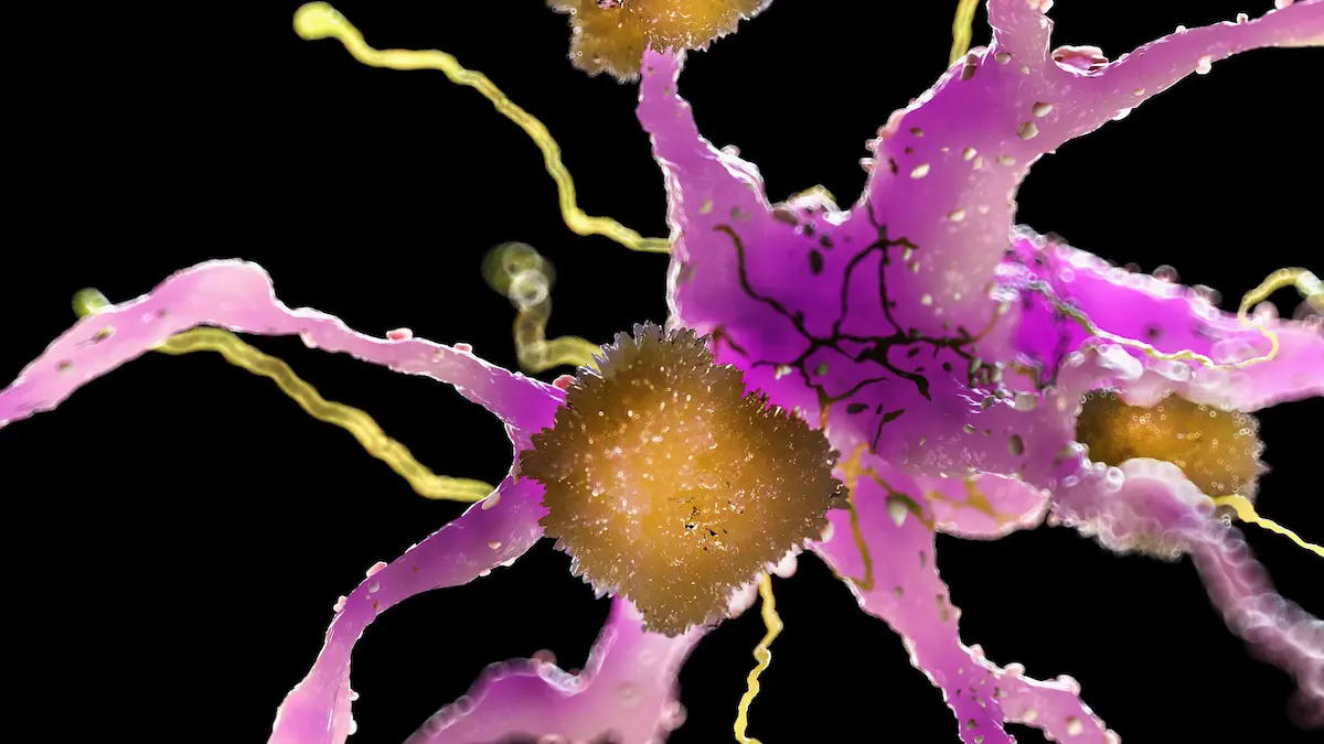 Alzheimer Tedavisinde Çığır Açan Gelişme: Beyin Plakları Saatler İçinde Temizlendi!