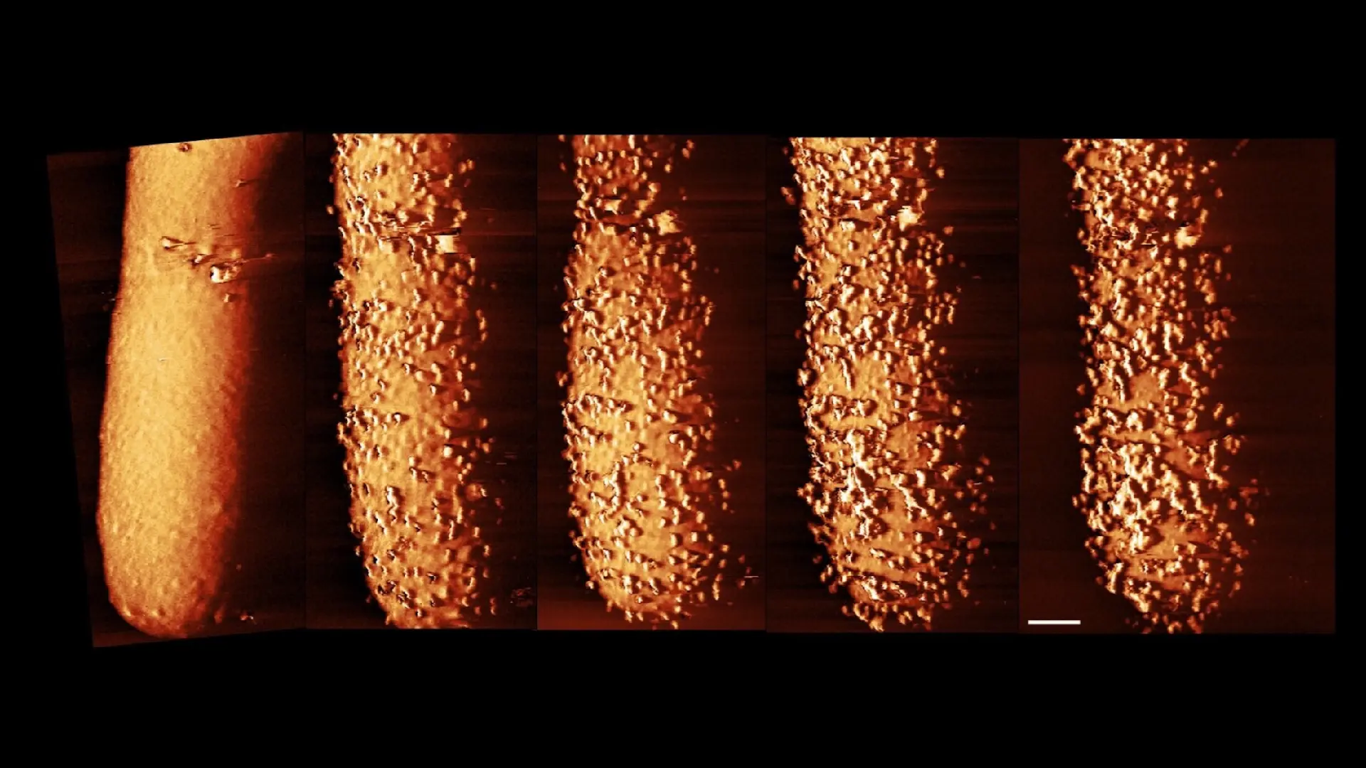 Antibiyotikler Bakterileri Canlı Canlı Yok Ediyor: O Anlar Görüntülendi!