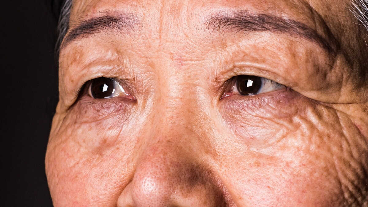 Gözleriniz Demansın Habercisi Olabilir: 12 Yıl Önceden Teşhis Mümkün mü?