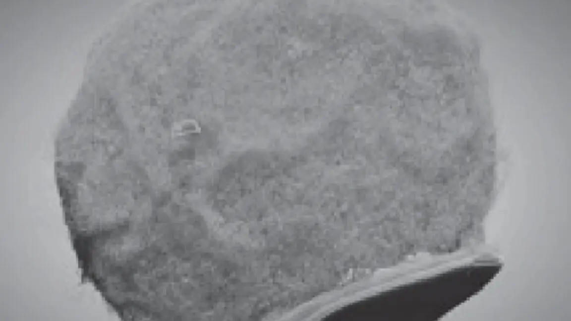 Vücudun Savunma Hücreleriyle Beyne Ulaşan Devrim Niteliğinde Mikroskobik Çipler