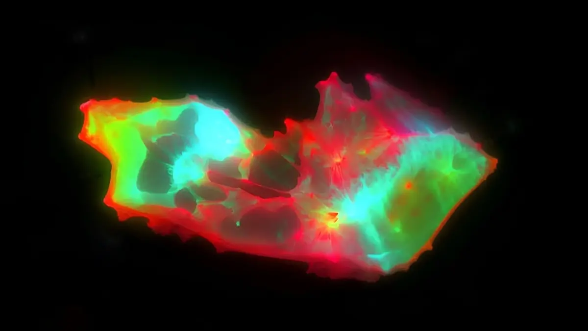 Long COVID'un Gizemli Belirtileri Kan Pıhtılarıyla Açıklanabilir mi?