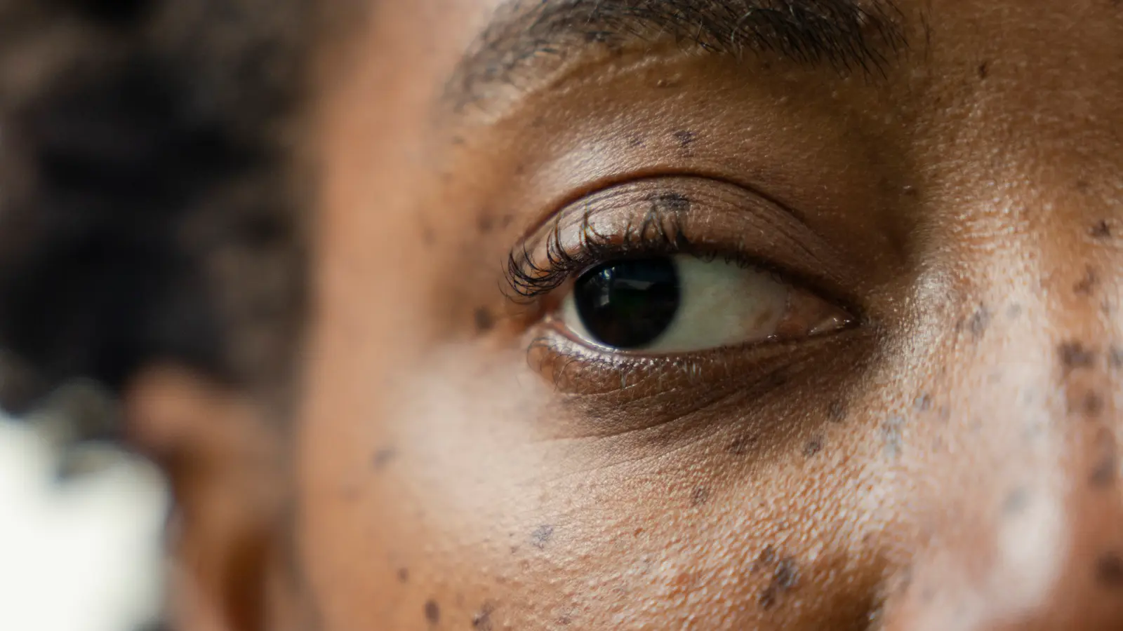 Gözdeki 'Tembellik' Anestezi ile Tedavi Edilebilir mi? Umut Vadeden Araştırma Sonuçları