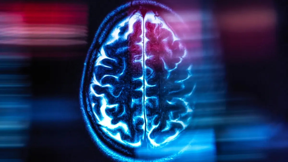 Semaglutide Alzheimer'a Karşı Çare Olmadı: Umutlar Yıkıldı