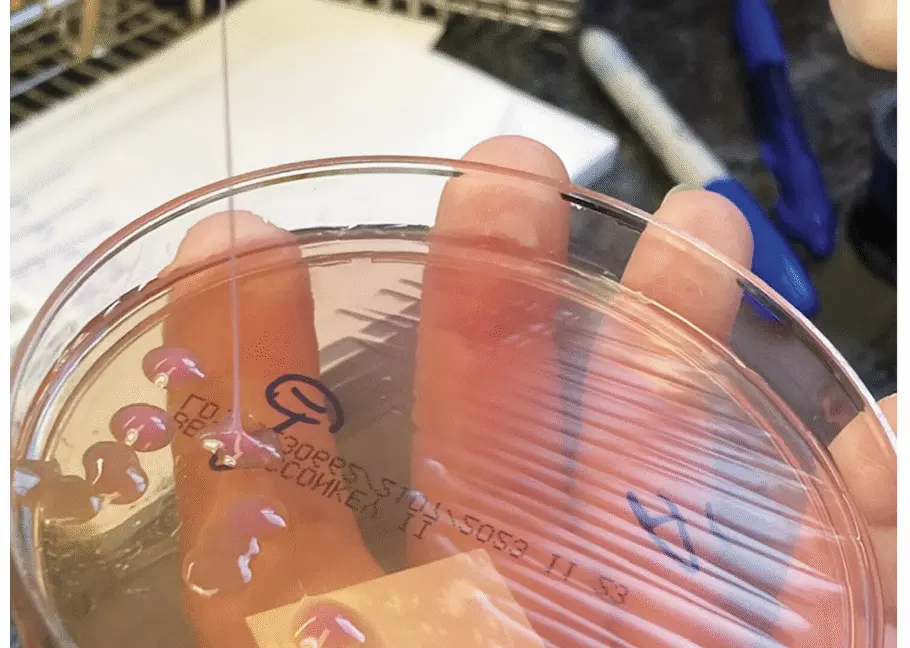 Tüyler Ürperten Bakteri: Beyin ve Organda Yayılan Tehlike Gözleri de Vurdu