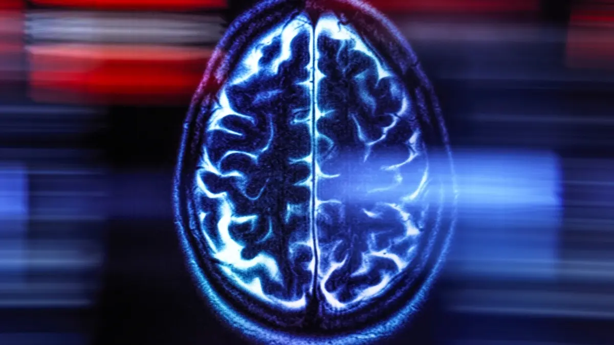 Demans Riskini Azaltmanın En Etkili Yolu: Vücut Saatinizi Düzenleyin