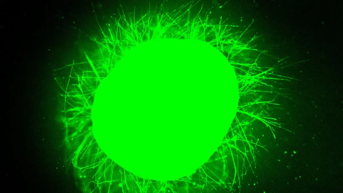 Bilim İnsanları Mini İnsan Omuriliklerini Büyüttü ve Yaralanma Sonrası Onarıldığını Gördü!