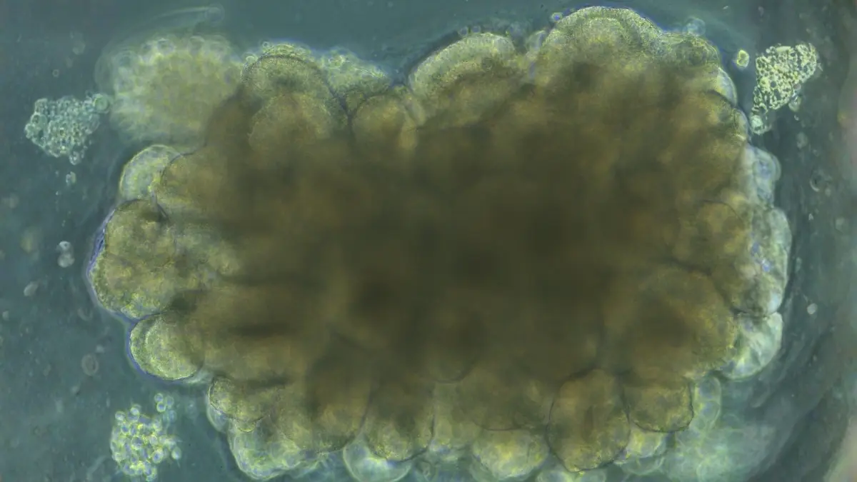 Laboratuvarda 'Mini Beyinler' Yetiştirildi, Mühendislik Problemi Çözdürdüler!