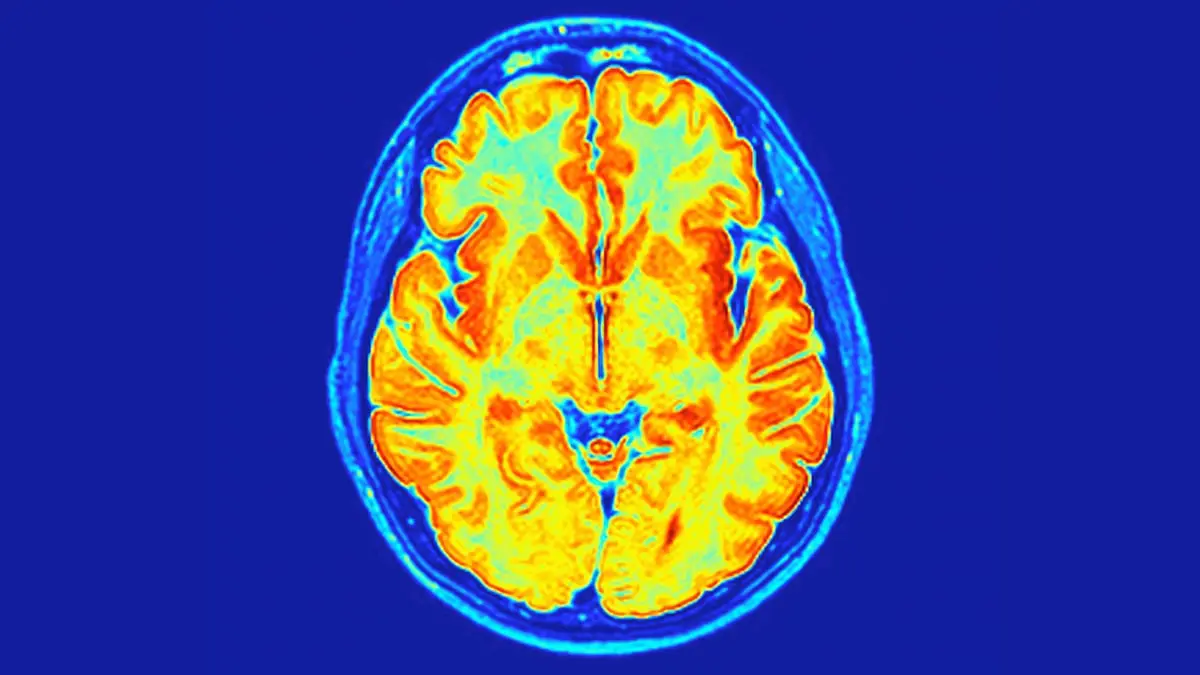 Genetik Haritamızda Gizlenen Yeni Bir Gelişimsel Bozukluk Keşfedildi: ReNU2 Sendromu