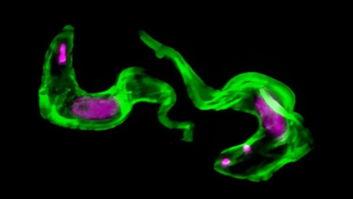 40 Yıllık Uyku Hastalığı Gizemi Çözüldü: Bilim İnsanları Parazitin Sırrını Aydınlattı
