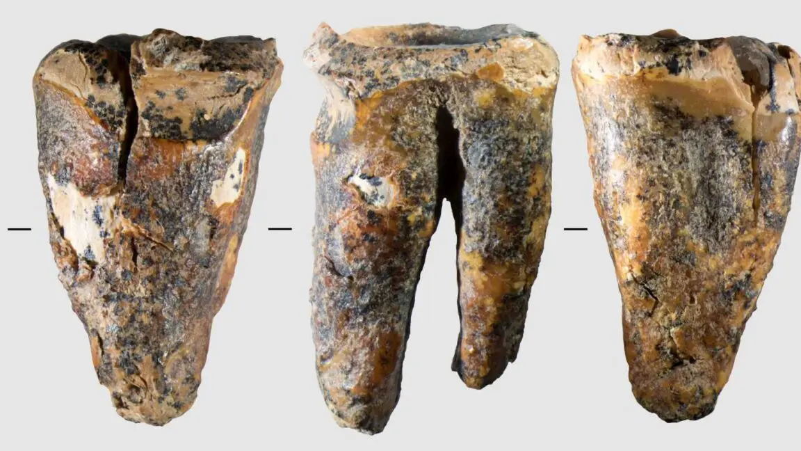 Neandertaller Diş Ağrısına Karşı 59 Bin Yıl Önce Diş Çekimi Yapmış Olabilir!