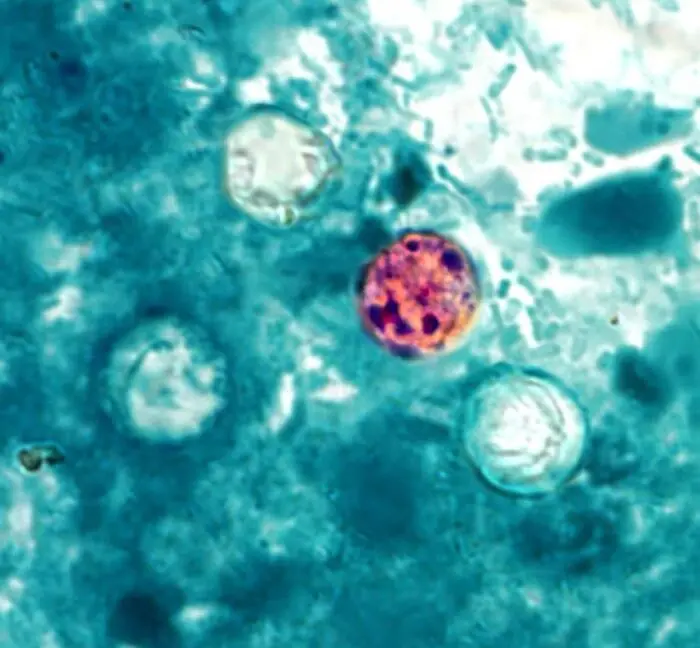 Rekor Kırılırken Bilim Durdu: Cyclospora Araştırmaları Askıya Alındı!